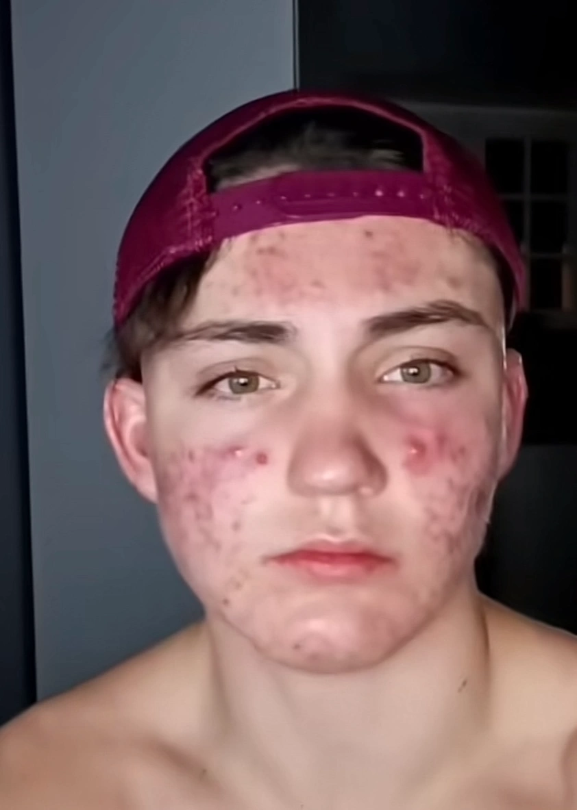 Avant transformation