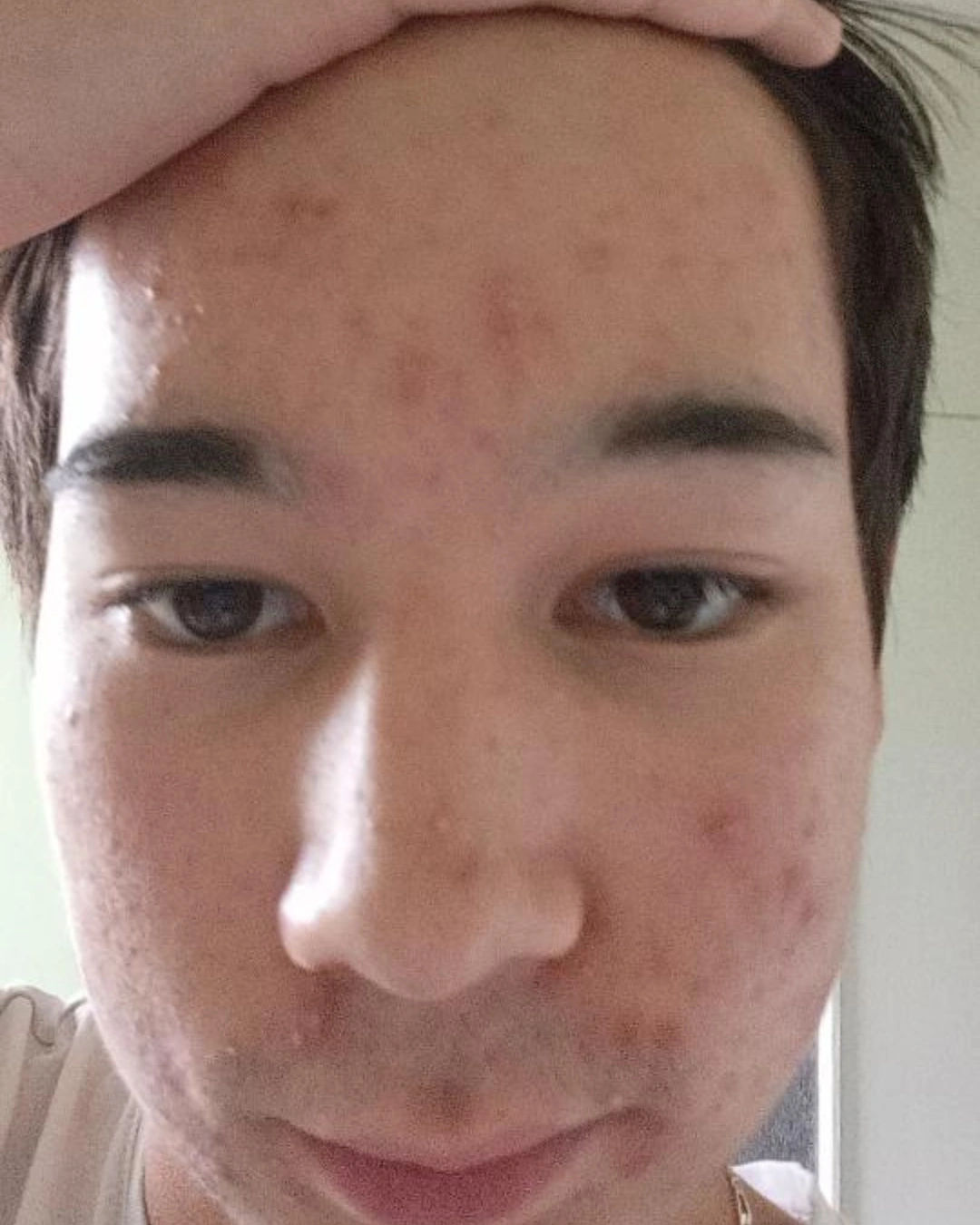 Avant transformation