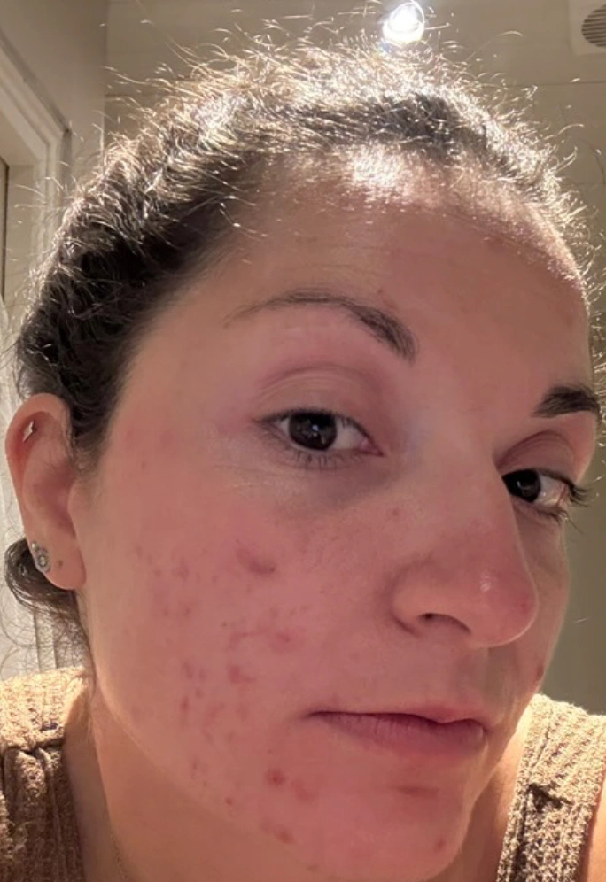 Avant transformation